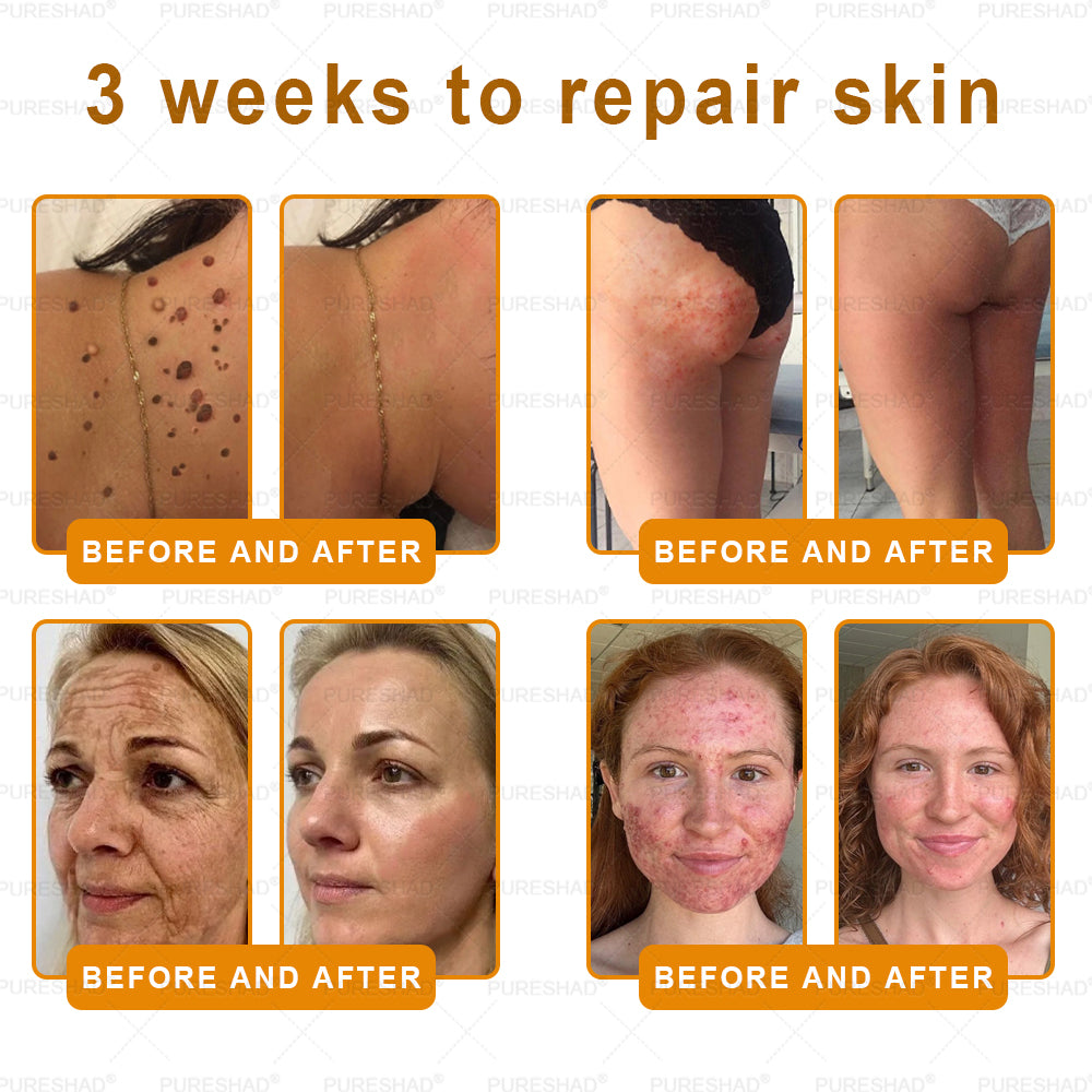 PureShade® has a surprise upgrade just for you! You've already got an amazing offer but now you've unlocked an even better one:You'll get a massive 50% off your next purchase - for the next two minutes only!