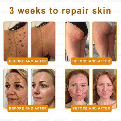 PureShade® has a surprise upgrade just for you! You've already got an amazing offer but now you've unlocked an even better one:You'll get a massive 50% off your next purchase - for the next two minutes only!