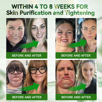 Congratulations! You have unlocked an exclusive Buildleaf® offer! i As a thank you for your order, we're offering an additional 30% off today! Click below to grab this special offer, offer expires!